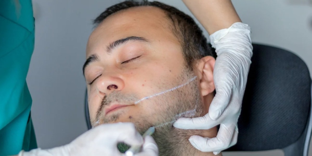 Can Jawline Fillers Improve Facial Symmetry?