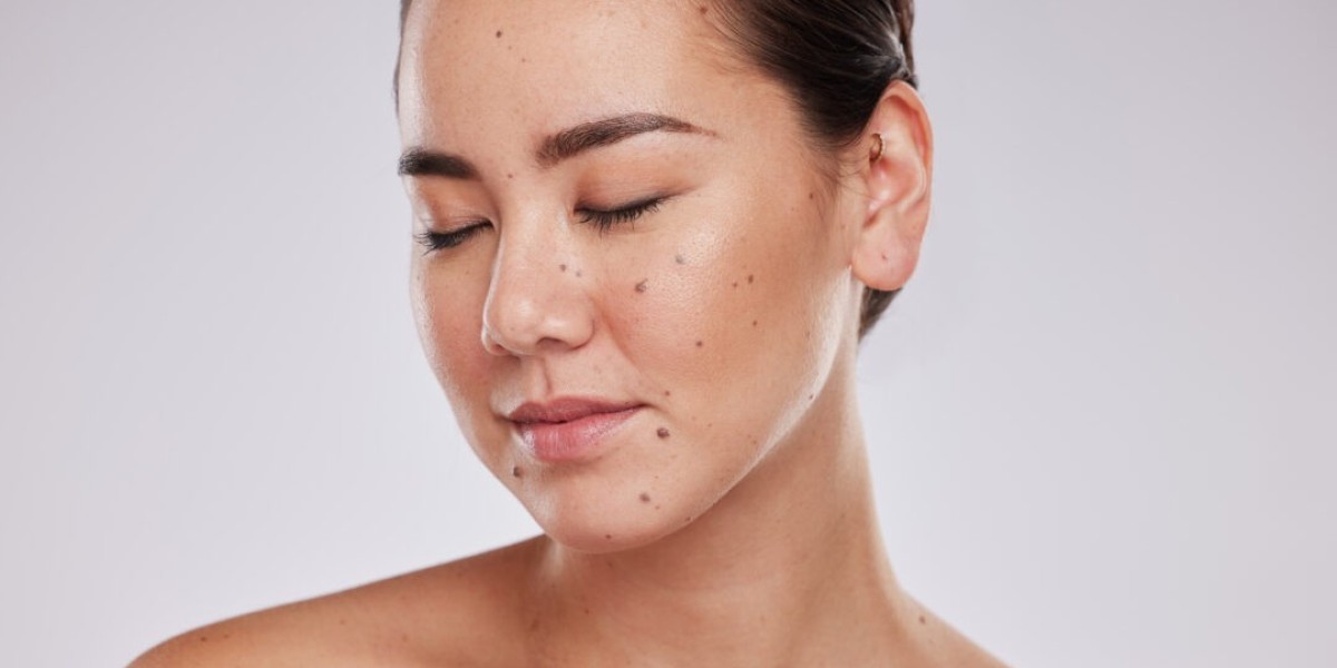 Does Skin Tag Removal Cause Pain?