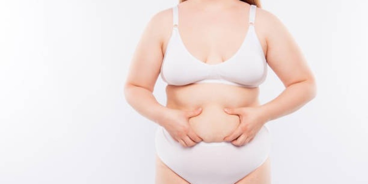 How to Maintain Your Tummy Tuck Results Long-Term