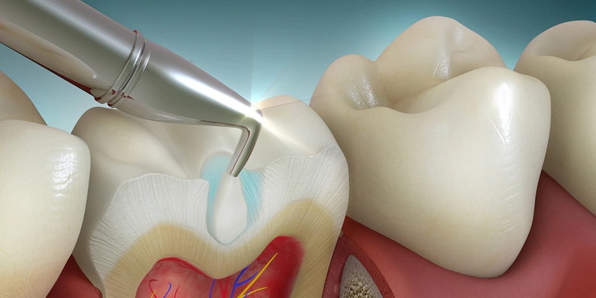 Tooth Filling Cost Differences Between Resin and Amalgam