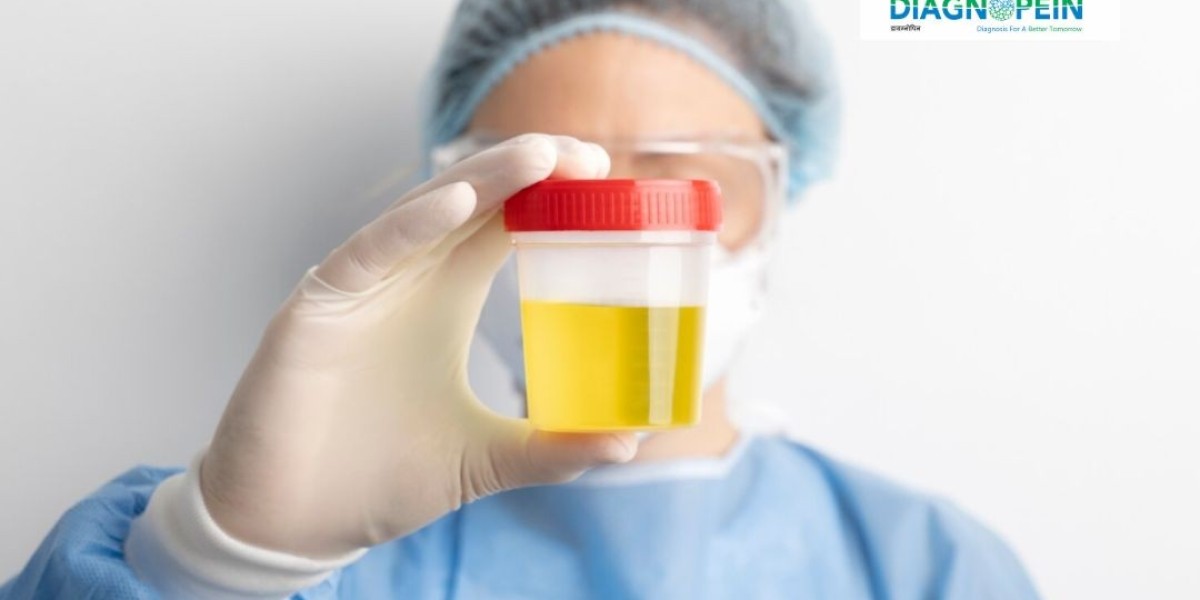 24-Hour Urine Albumin Test – Early Kidney Damage Detection Guide