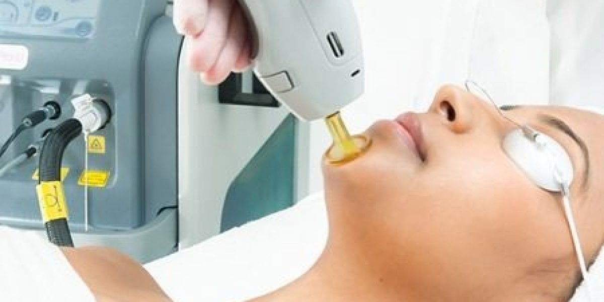 Laser Hair Removal in Dubai for Women: A Complete Guide