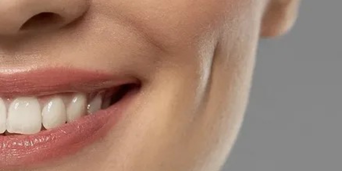 What Is Dimple Creation Surgery? A Complete Guide for Patients in Islamabad
