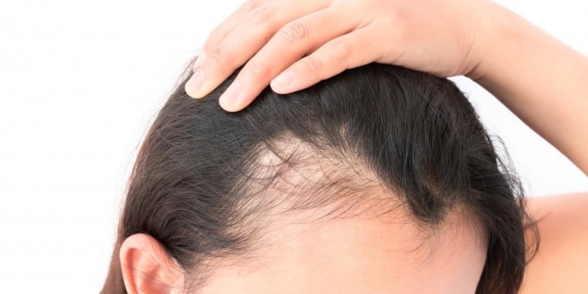Hair Loss Treatment Products Growth Trends, Forecast to 2033