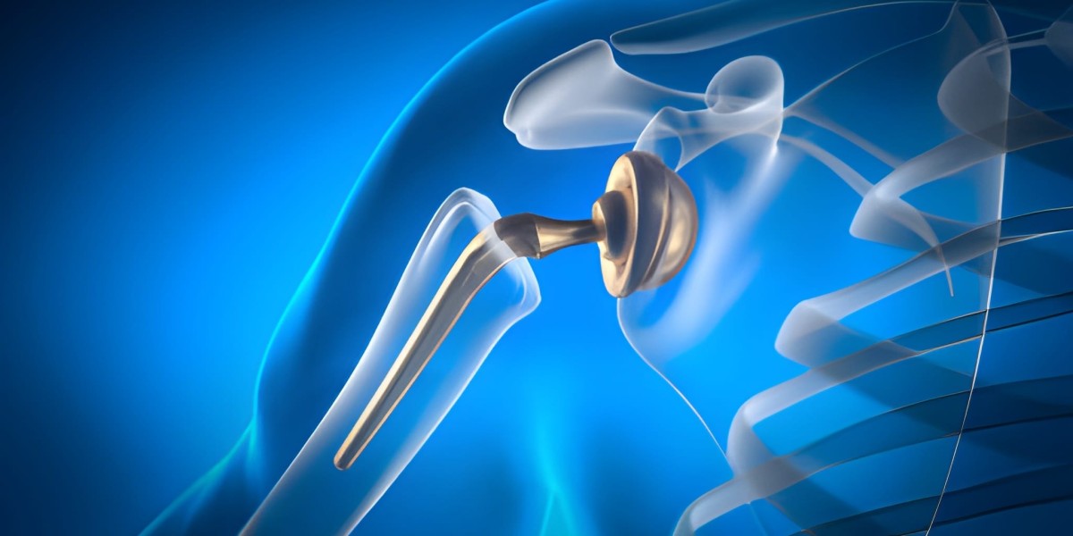 Shoulder Replacement Devices: Innovations, Trends, and Future Prospects