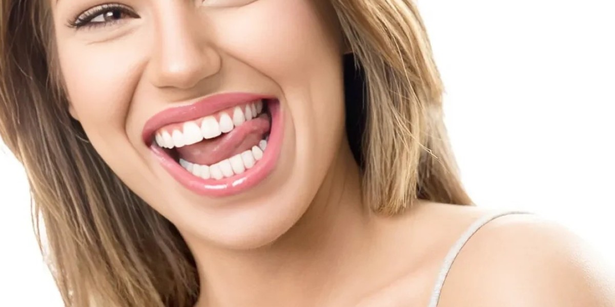 Teeth Whitening in Dubai to Help You Feel More Confident Instantly