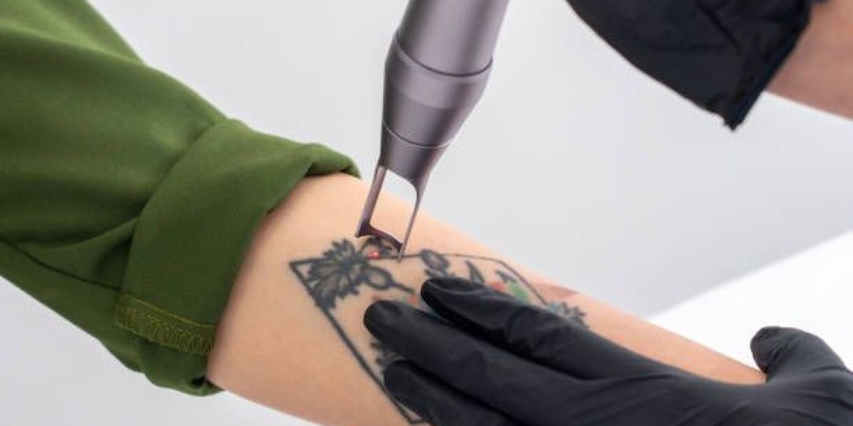 Tattoo Removal in Dubai: Preparing for Summer Treatments