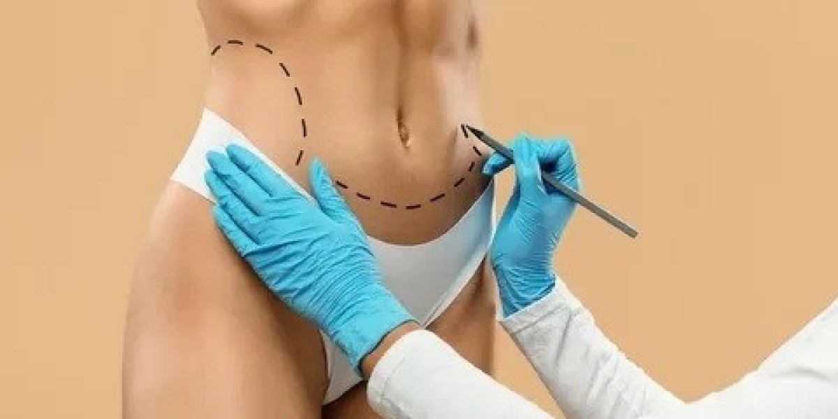 Circumferential Abdominoplasty vs Traditional Tummy Tuck: Which One Is Right for You?
