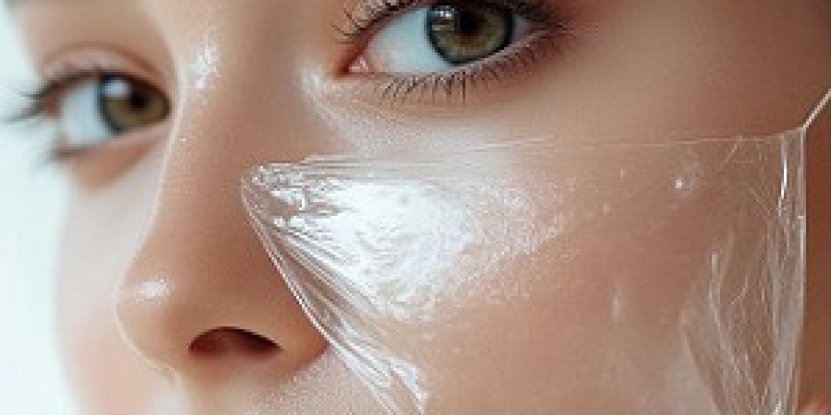 Chemical peels in Dubai: Transform Your Skin Today