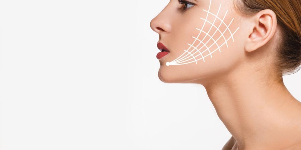 Is Silhouette Facelift a Non-Surgical Option?