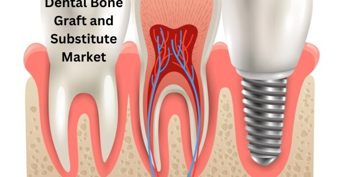Dental Bone Grafts and Substitutes Market Growth - Market Analysis, Size, Share, Trends, Demand, Overview and Segment Fo