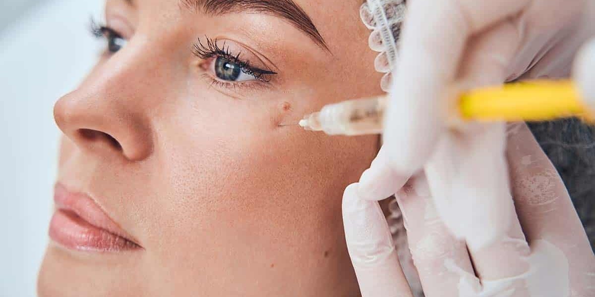 Can Cosmetic Injectables Treat Fine Lines Around Eyes?