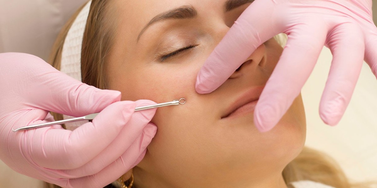 How a Deep Cleansing Facial with Extraction Promotes Clearer Skin