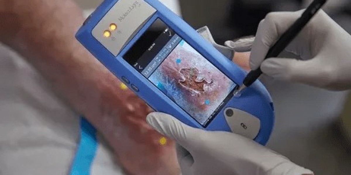Global Digital Wound Measurement Devices Market Size, Trends & Forecast