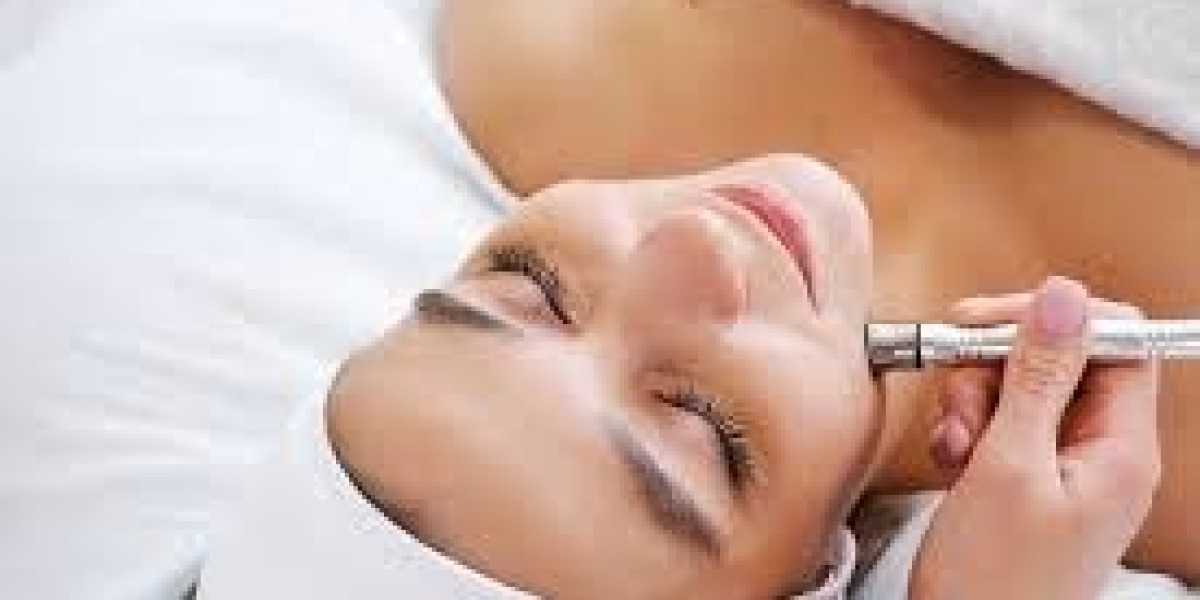 How to Prepare for Microneedling for Acne Scars