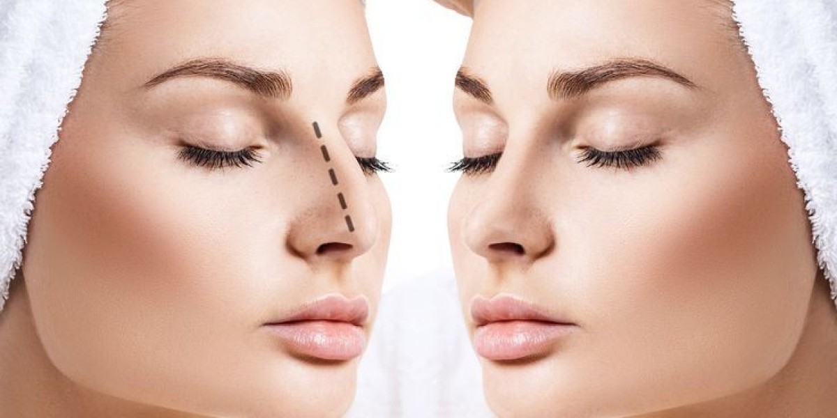 Rhinoplasty in Dubai: A Comprehensive Guide to Facial Transformation