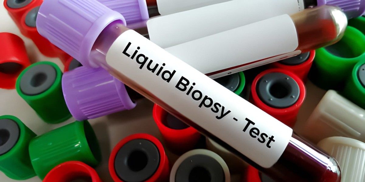 Liquid Biopsy in Cancer Diagnostics: Revolutionizing Cancer Care