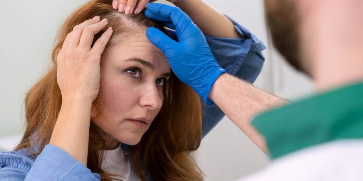 Recovery and Aftercare Tips After a Hair Transplant in Dubai
