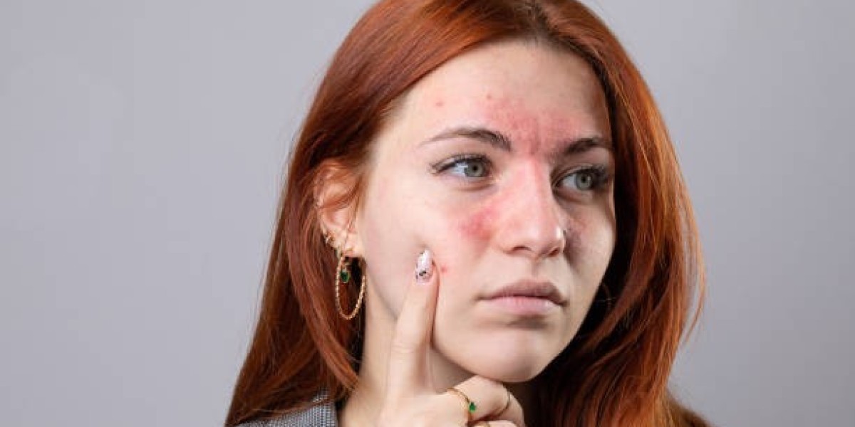 Skin Reddening Near Nasal Bridge: Causes and Solutions