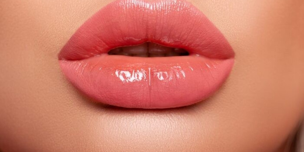 Top Benefits of Lip Fillers in Islamabad for a Youthful Look
