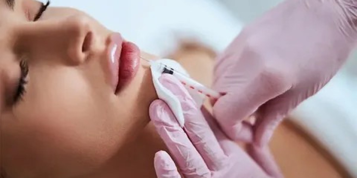 Fillers in Dubai: Mastering the Recovery Timeline and Aftercare
