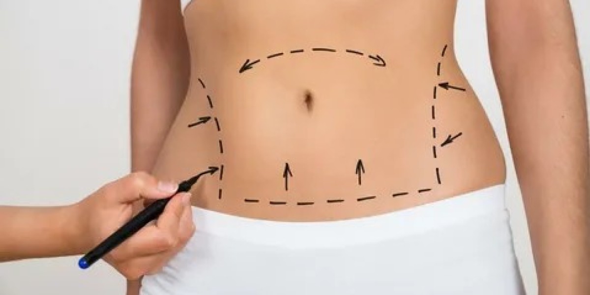 Liposuction in Dubai Myths: Debunking Common Misconceptions