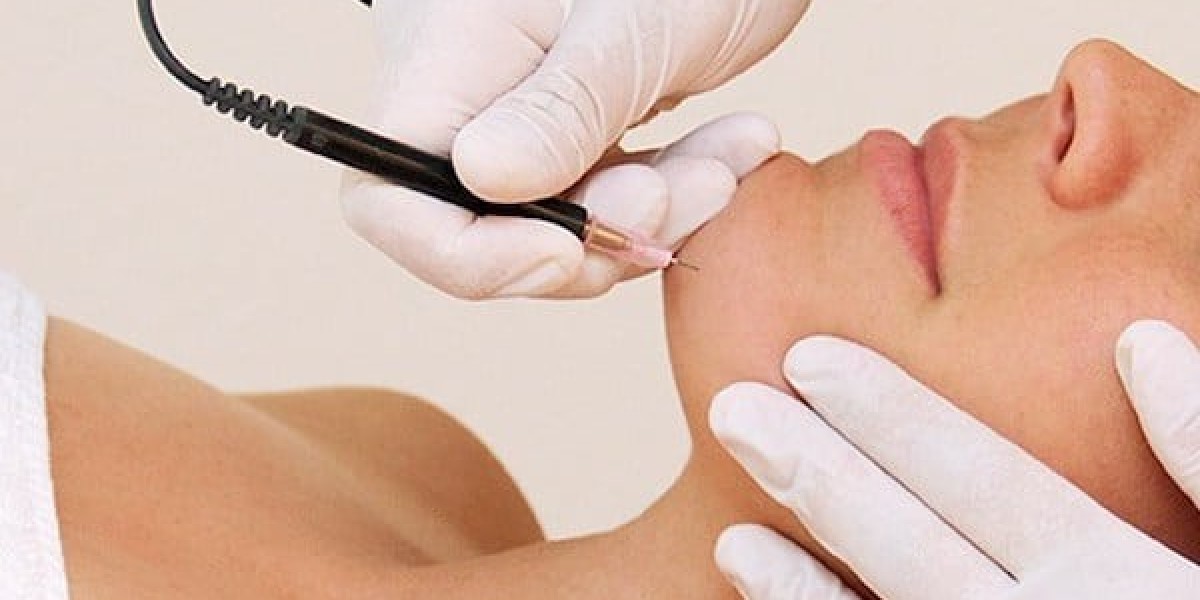 Post-Care Tips for Electrolysis Hair Removal: Maximize Your Results