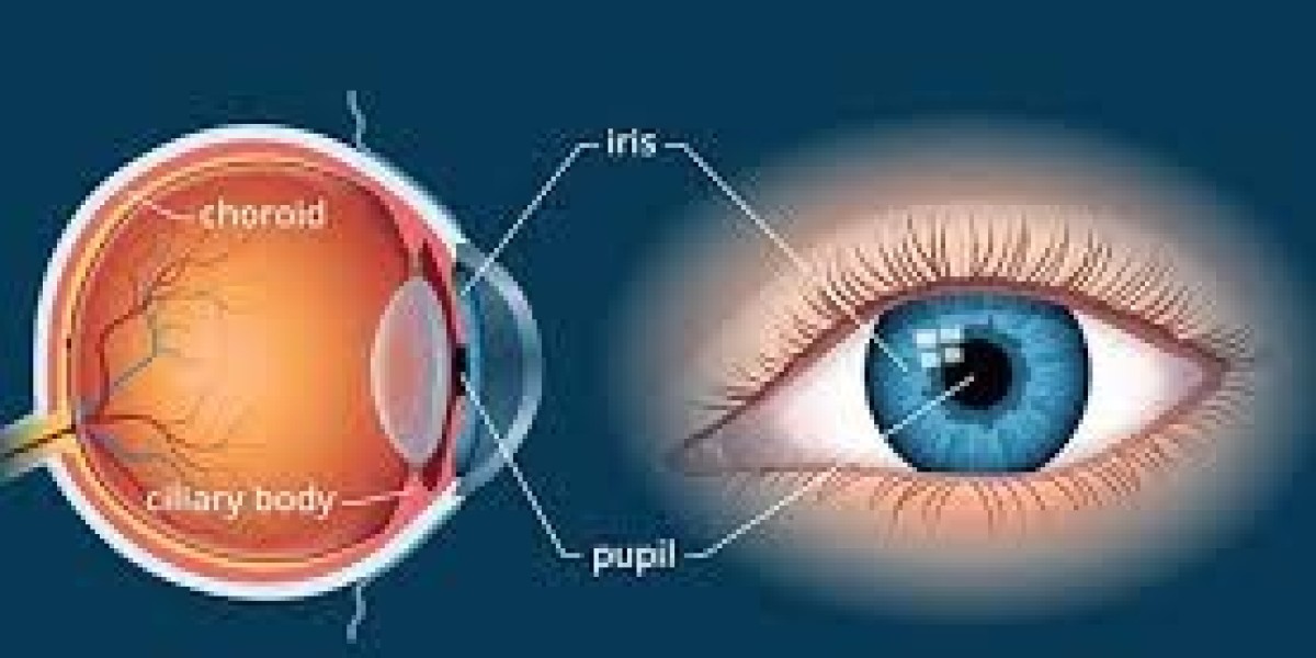 Choroidal Neovascularization Market Key Developments and Forecast 2034