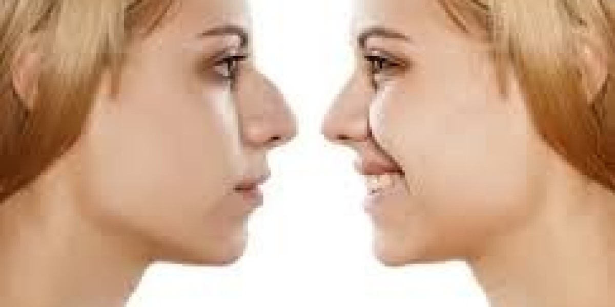 Your Guide to Affordable Rhinoplasty in Dubai