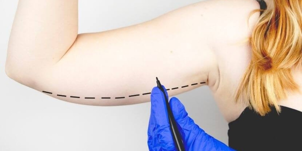 The Rise of Cosmetic Excellence: Arm Lift Surgery in Riyadh