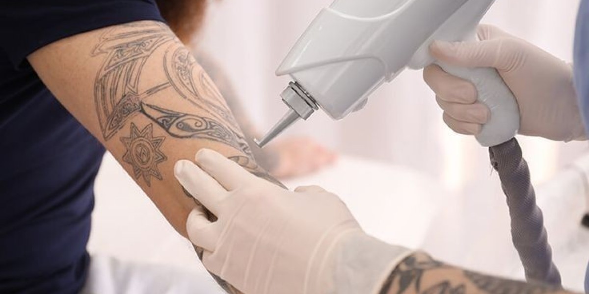 Tattoo Removal in Dubai: Safe, Effective Solutions for Lasting Results