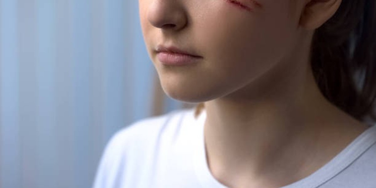 Facial Scar Revision in Dubai vs. Abroad: Why Stay Local?