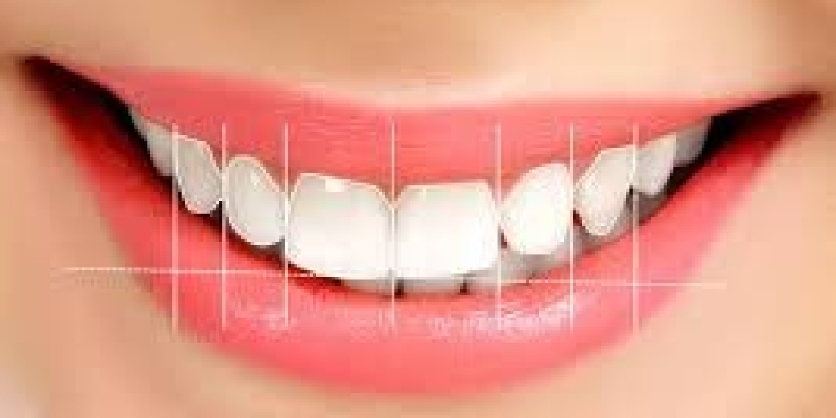 How Does Digital Smile Design Enhance Smile Precision?
