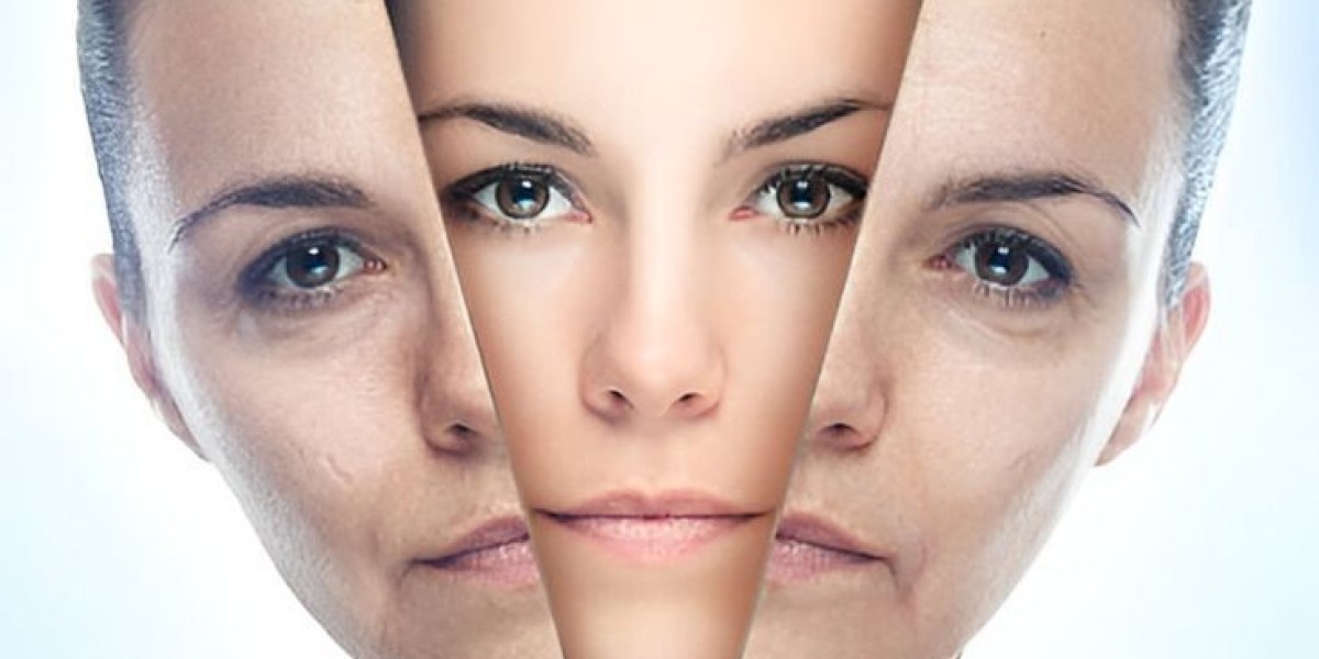 Top Benefits of Choosing Glutathione Injection in Dubai for Radiant Skin