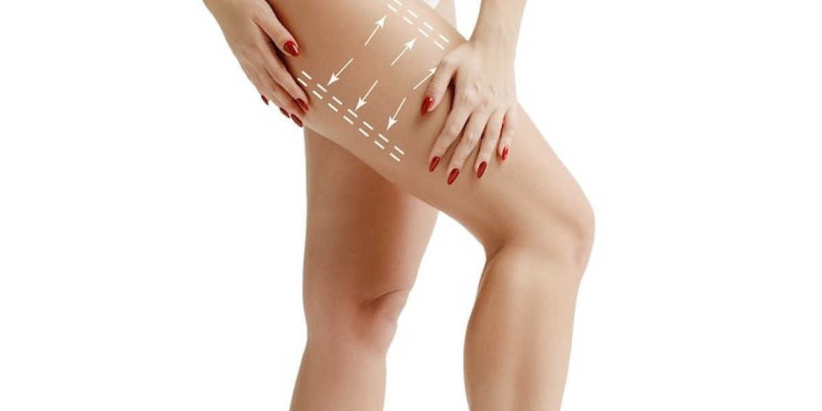 Thigh Lift in Dubai Recovery: Quick Tips for Smooth Healing