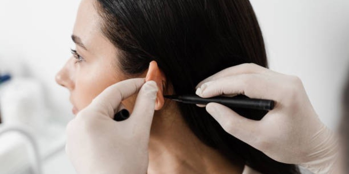 premium-otoplasty-in-dubai-celebrity-level-ear-reshaping