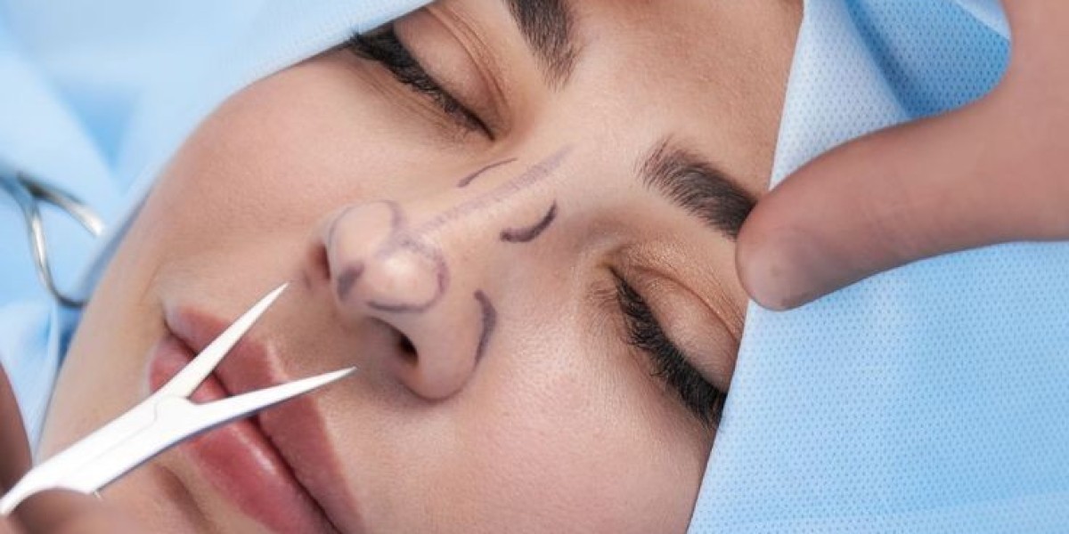 Rhinoplasty in Dubai: A Patient’s Guide to Safe and Successful Surgery