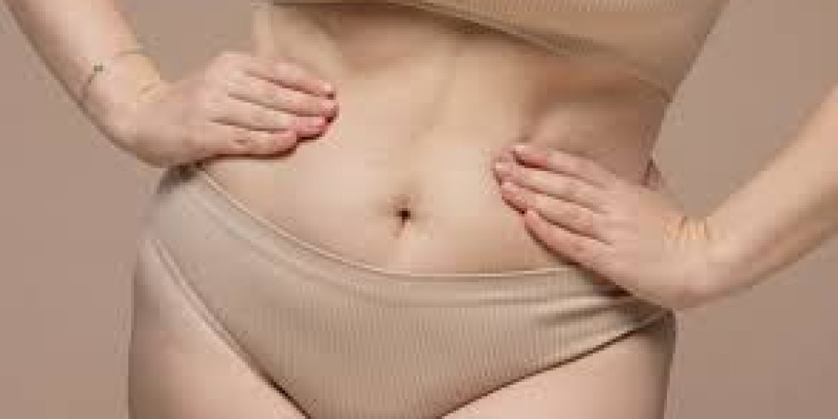 360 Liposuction in Dubai: Complete Body Contouring Explained