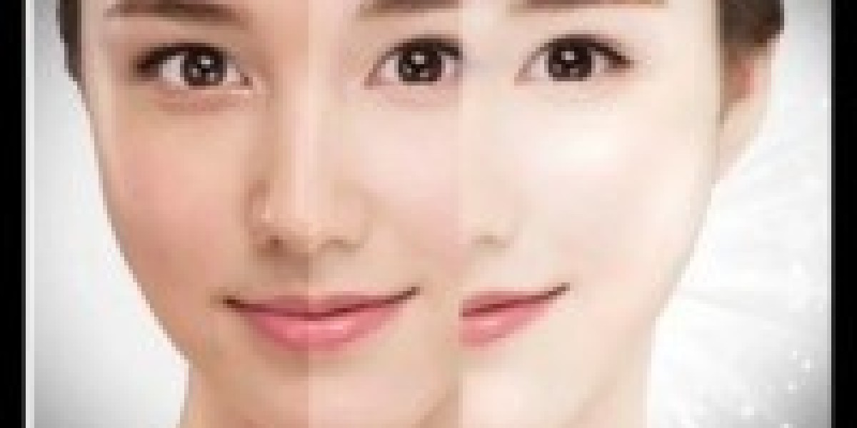 Skin Whitening: Preparing Your Skin for Special Occasions