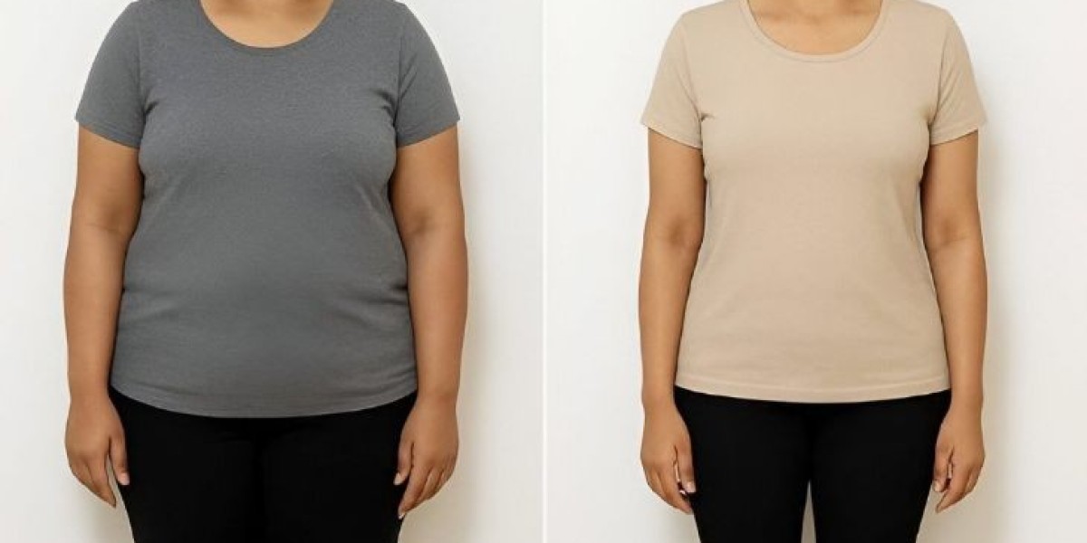 Mounjaro Injection in Islamabad: Doctor-Supervised Weight Loss Care