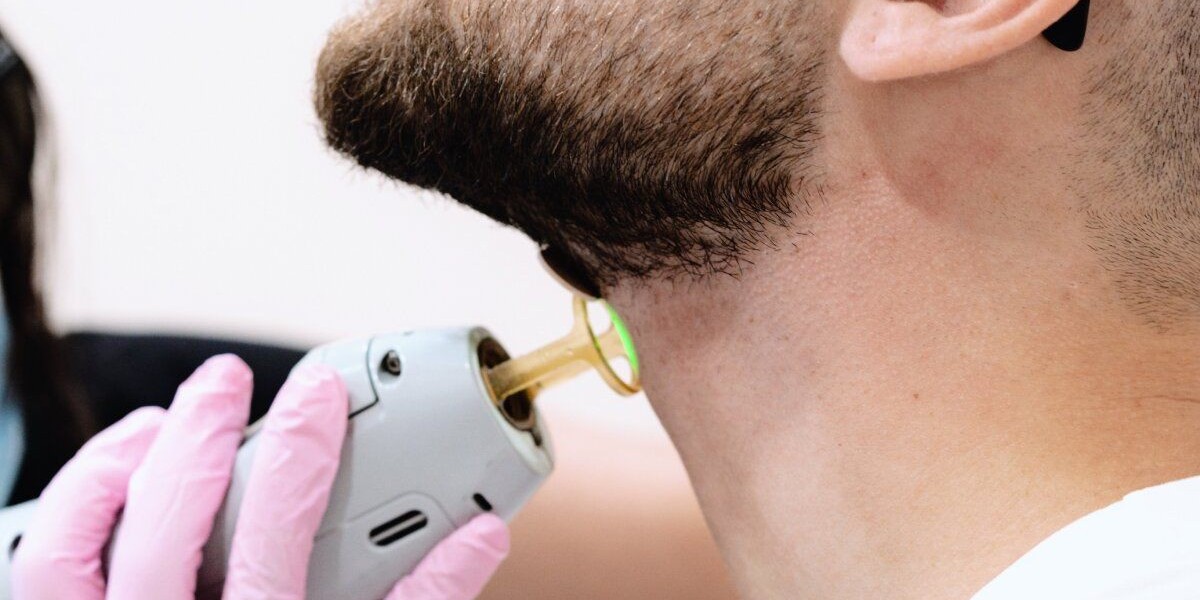 How Often Should You Get Laser Hair Removal in Dubai? A Complete Schedule Guide