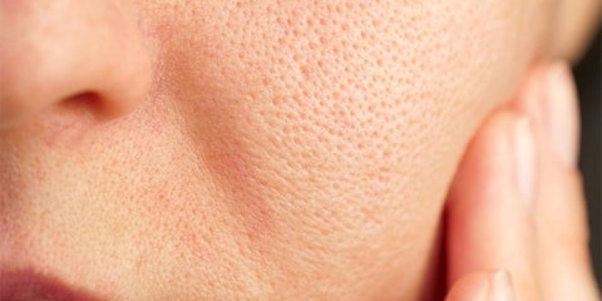 Are Large Pores a Sign of Aging or Oily Skin?