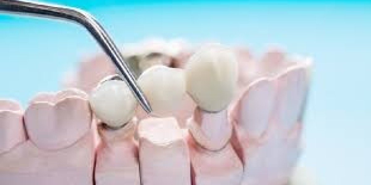 Anew Cosmetic Clinic – Trusted Cosmetic Dentist in Bangalore for a Confident Smile