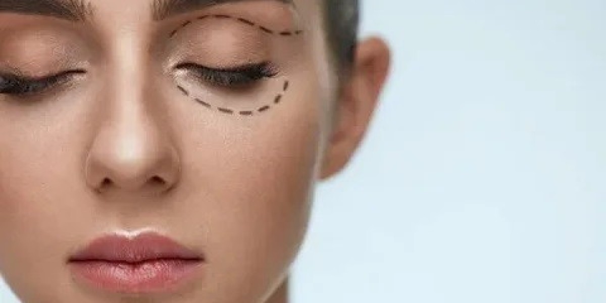 Top Benefits of Eyelid Surgery: Why Choose Blepharoplasty in Islamabad