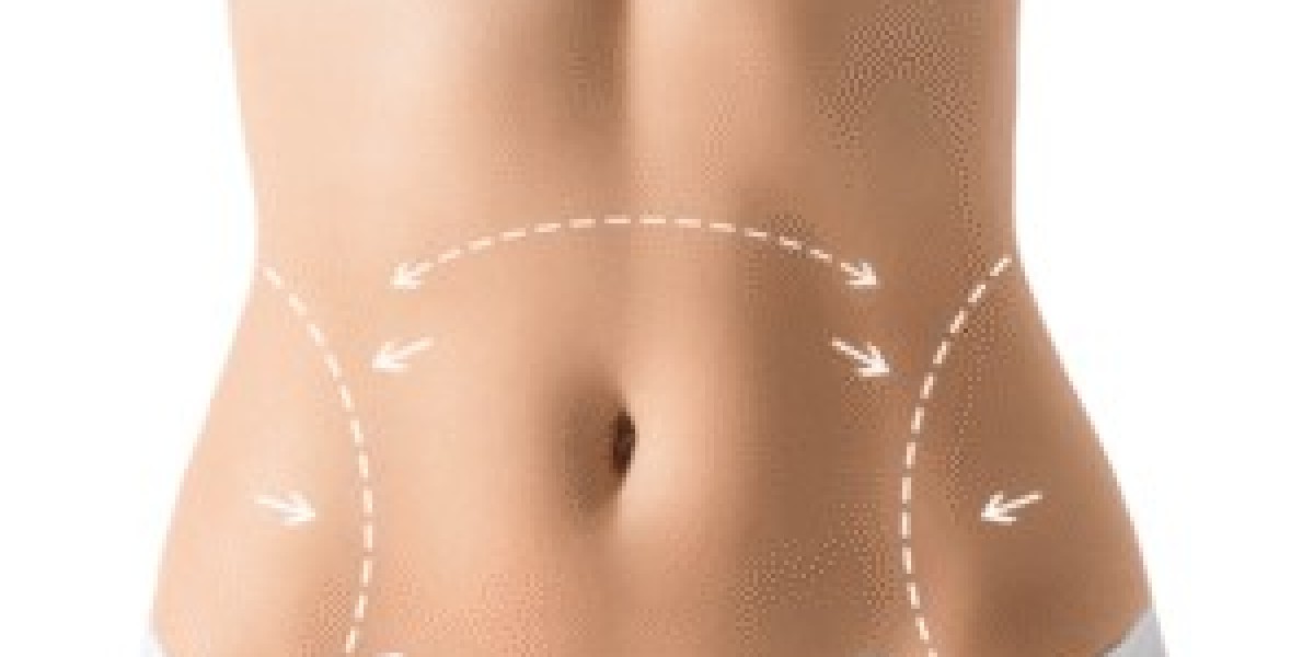 Liposuction in Dubai: Minimally Invasive Techniques for Faster Recovery