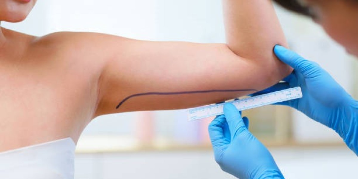 Safe Liposuction Practices: Choosing Techniques That Prioritize Patient Safety