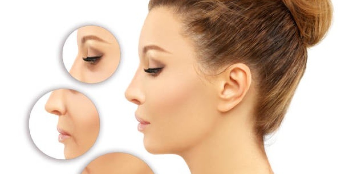 Elevate Your Profile with Vector Facelift in Dubai Now