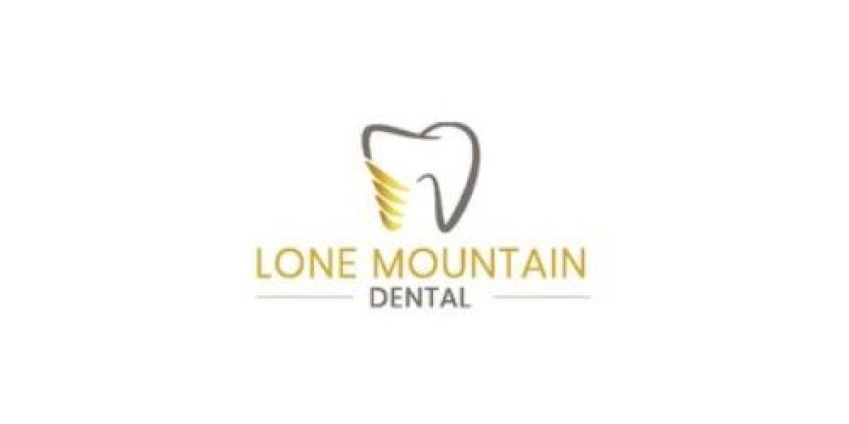 Why Are All-on-4 Dental Implants Preferred Over Traditional Dentures?