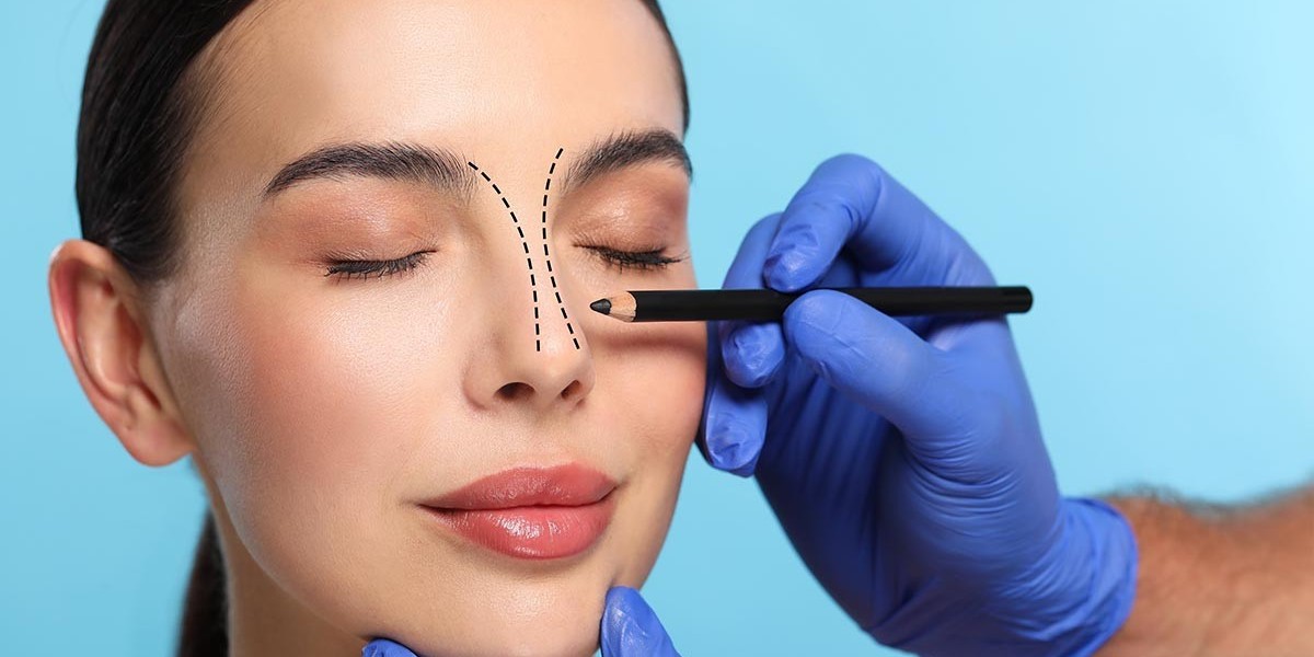 How Septoplasty Can Improve Your Breathing and Quality of Life