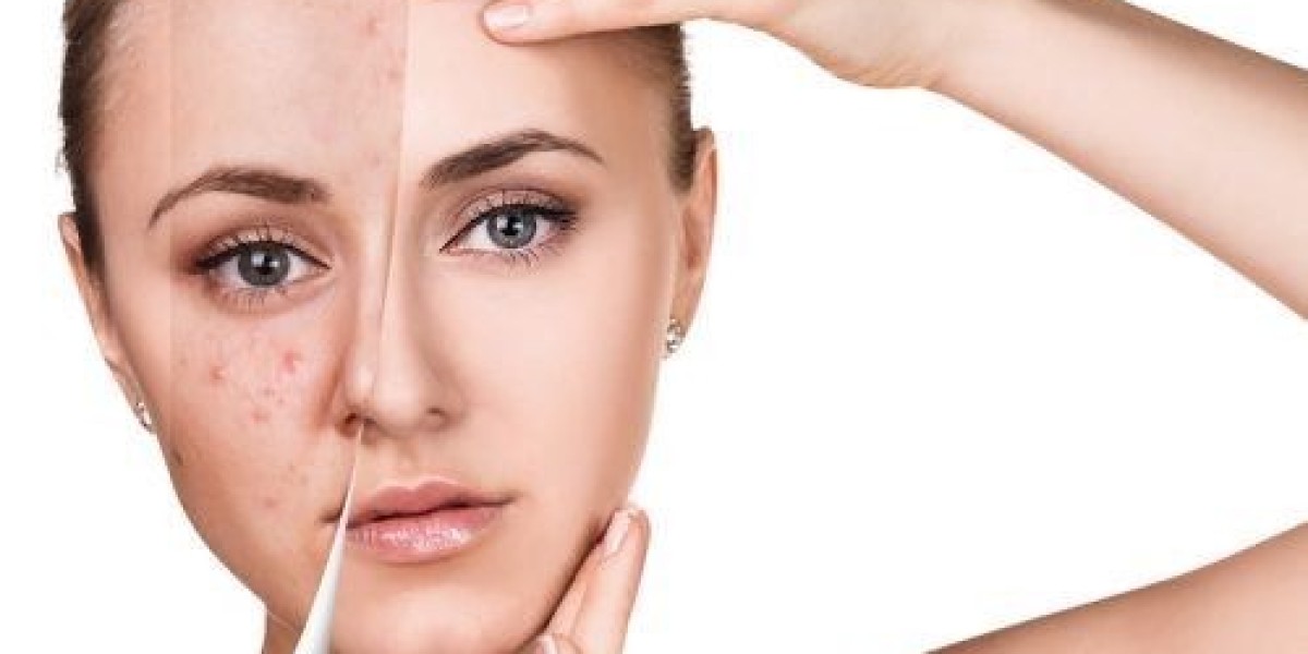 Top 5 Reasons People Choose Glutathione Injections in Dubai